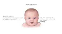 Kiedy wiadomo, że dziecko ma zespół Downa? Objawy i diagnoza