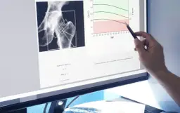 Die entscheidenden Schritte zur Osteoporose Diagnostik verstehen