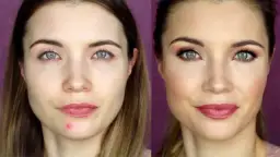 Jak zatuszować pryszcze: skuteczne triki na idealną cerę