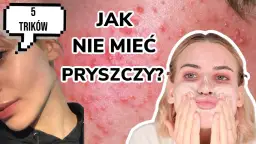 Gładka cera bez pryszczy? Odkryj sekrety eksperta!