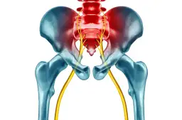 Jakie badania są potrzebne przy rwie kulszowej, aby uniknąć bólu?