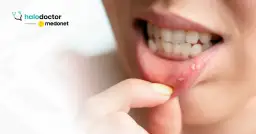 Choroby jamy ustnej: Do jakiego lekarza się udać?