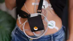 Holter EKG a nerwica: Co naprawdę mówi o Twoim sercu?