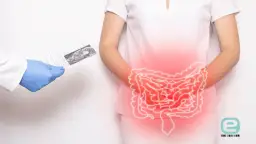 Ból brzucha u dziecka: Czy to IBS? Diagnostyka i badania.