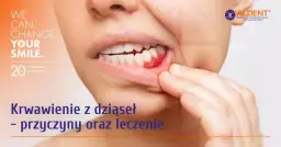 Jak zatamować krwotok z dziąsła? Szybkie sposoby i przyczyny