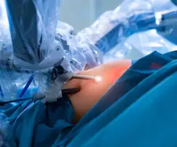 Robot da vinci refundacja nfz gdzie - jak uzyskać darmowe leczenie?