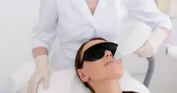 Kobieta w okularach ochronnych przechodzi zabieg depilacji laserowej. Czy warto? To pytanie zadaje sobie wiele osób.