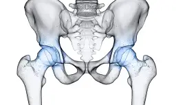 Endoproteza stawu biodrowego NFZ - gdzie najszybciej bez czekania