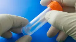 Jak długo można przechowywać kał do badania, by uniknąć błędów?