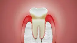Co na dziąsła? Skuteczne sposoby na ból, krwawienie i zapalenie
