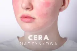 Czego unikać przy cerze naczynkowej, aby uniknąć podrażnień i zaczerwienień