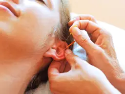 Akupunktura Kraków Cennik: Pełna Transparentność i Twoje Zdrowie