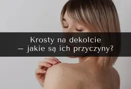 Pryszcze na dekolcie? Odkryj przyczyny i skuteczne rozwiązania!