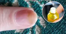 Olejek herbaciany na paznokcie: Grzybica, hybryda pełny poradnik