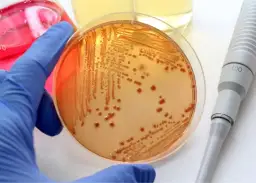 Wysokie CRP przyczyny: co oznacza wysoki poziom białka C-reaktywnego?