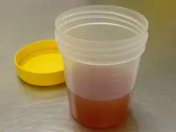 Ciemny mocz u psa: Przyczyny i co robić w takiej sytuacji?