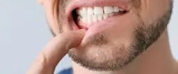Jak skutecznie leczyć zapalenie dziąseł i uniknąć poważnych problemów