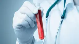 Co to jest HGB w badaniu krwi i dlaczego jest tak ważne dla zdrowia