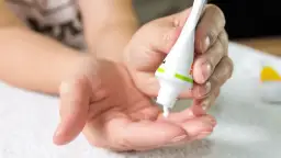 Czy maść cynkowa pomaga na pryszcze? Dłoń aplikuje biały krem z tubki, sugerując domową kurację.