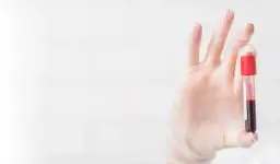 Co oznacza PLT w badaniu krwi i jakie może mieć konsekwencje?