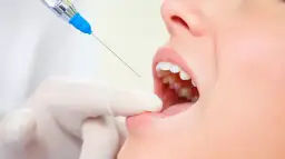 Bezbolesny dentysta? Znieczulenie w stomatologii: metody i bezpieczeństwo