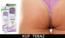 Krostki na pośladkach? Poznaj 3 kroki do gładkiej skóry!