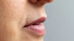Jak usunąć kwas hialuronowy z ust domowe sposoby, które nie działają