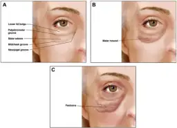 Opuchlizna na kościach policzkowych: przyczyny, które mogą zaskoczyć