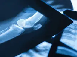 Czy fizjoterapeuta może wystawić skierowanie na rezonans? Sprawdź!