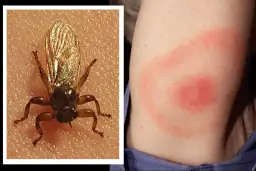 Latający kleszcz: objawy ukąszenia, czy grozi boreliozą?