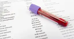 Jakie badania krwi przed wizytą u gastrologa? Co musisz wiedzieć?