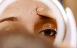 Jak zakryć pryszcze: skuteczne triki na idealną cerę bez blizn