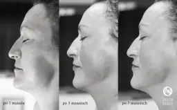 Masaż Kobido: Naturalny lifting twarzy? Poznaj efekty i etapy