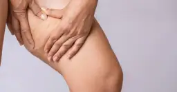 Dłoń uciska udo z widocznym cellulitem. Moja historia: jak pozbyłam sie cellulitu.