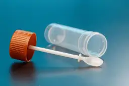 Kalprotektyna: Co oznacza jej podwyższony poziom w kale?