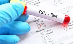 Badanie TSH: Co musisz wiedzieć o zdrowiu tarczycy?