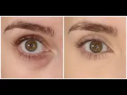 Jak zatuszować worki pod oczami? Makijaż krok po kroku!