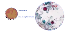 Blastocystis hominis: Jak rozpoznać i skutecznie leczyć?
