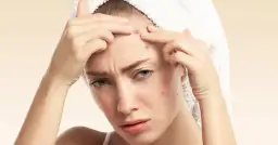 Jak szybko pozbyć się pryszcza i uniknąć blizn na skórze