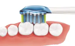 Co wzmacnia zęby i dziąsła? Poznaj skuteczne sposoby na zdrowie jamy ustnej