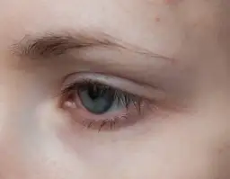 Dlaczego rzęsy krzywo rosną? Odkryj przyczyny i rozwiązania