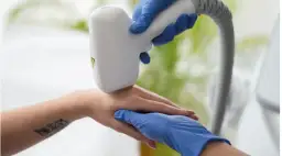 Depilacja SHR co to? Poznaj skuteczną metodę usuwania włosów