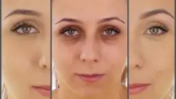 Korektor na sińce pod oczami: Jak wybrać i aplikować? Poradnik