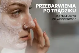 Jak pozbyć się blizn po pryszczach? Domowe i profesjonalne metody