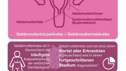 Symptome bei Gebärmutterkrebs: Warnzeichen, die Sie nicht ignorieren sollten