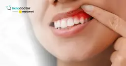 Ból dziąseł? Co robić, by szybko poczuć ulgę i kiedy iść do dentysty