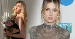 Modelka z bliznami? Tak, to możliwe! Autentyczność to nowy atut w modzie.