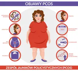 PCO syndrom co to jest – objawy, przyczyny i wpływ na zdrowie kobiet