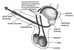 Czy wazektomia to grzech? Odkryj moralne aspekty w Kościele katolickim
