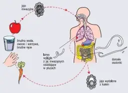 Pasożyty w ciele: 7 alarmujących objawów i co robić?